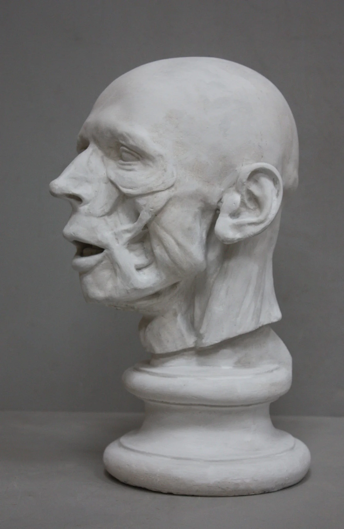 Anatomy of Man's Head - Item #417 - Image 3