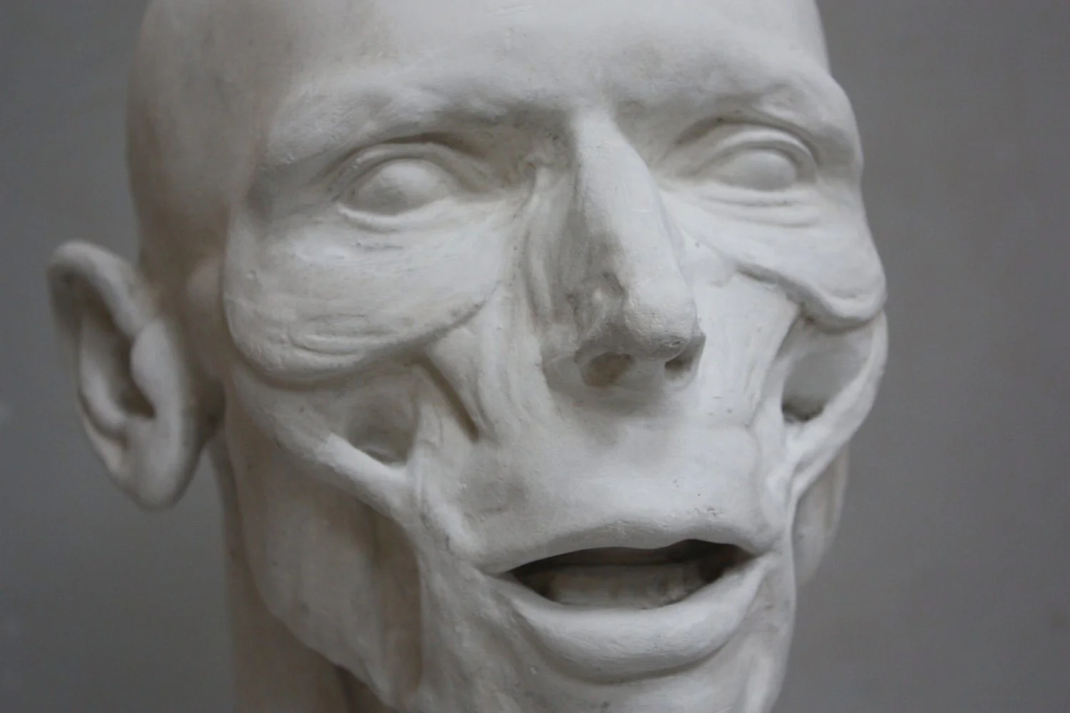 Anatomy of Man's Head - Item #417 - Image 4