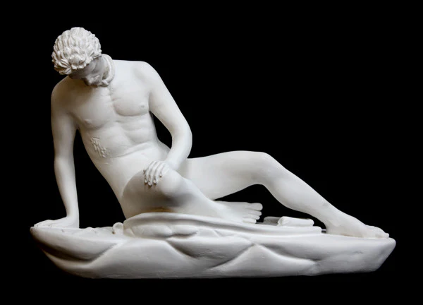 Caproni Reproduction of Dying Gaul - Item #801 - Image 2