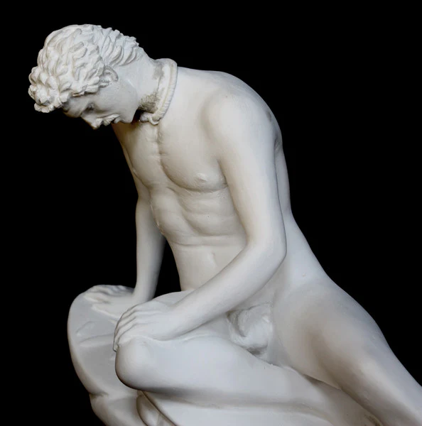 Caproni Reproduction of Dying Gaul - Item #801 - Image 4